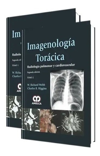 Imagenología Torácica -radiología Pulmón Cardiov 2 Ed 2tomos