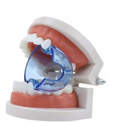 Abrebocas Retractor De Aislamiento Dental X 2 Unid