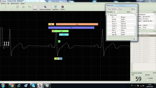 Software Easy G Para Electrocardiografos Temis
