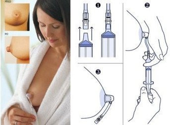 Philips Avent Niplette Bebe Corrector Pezon Mamas Senos X 1 - Leche Materna - Lactancia - Mama & Bebe - Alimentacion -