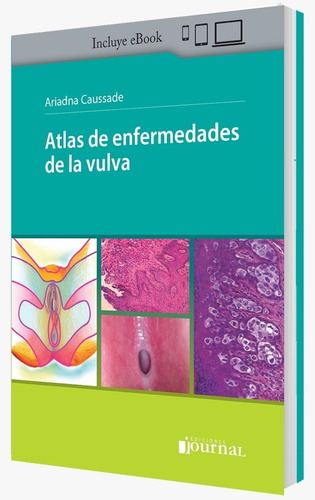 Atlas De Enfermedades De La Vulva Caussade  1ª Ed Año 2022