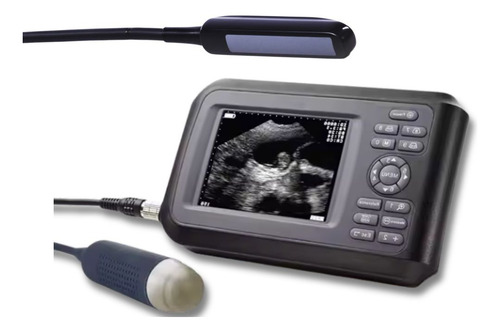 Ultrassom Com 02 Prob Retal E Convexa