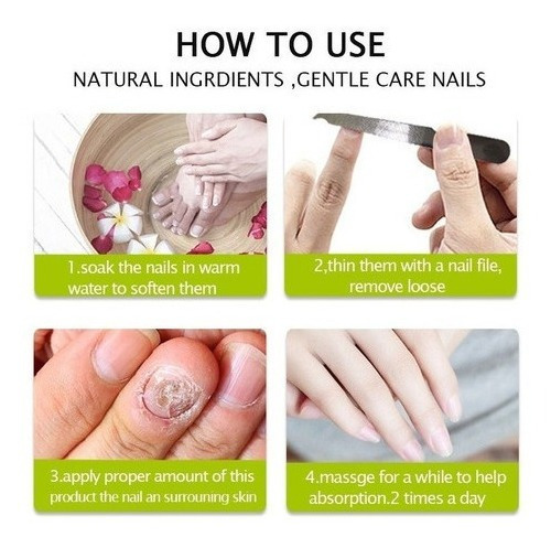 Imagen 5 de 6 de Gel De Uñas Efero De 7 Piezas, Tratamiento Eficaz Para Mi