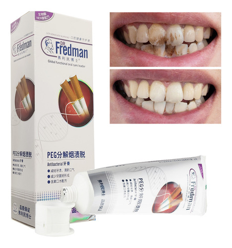 110g De Higiene De Carvão Vegetal Creme Dental Branco Para H