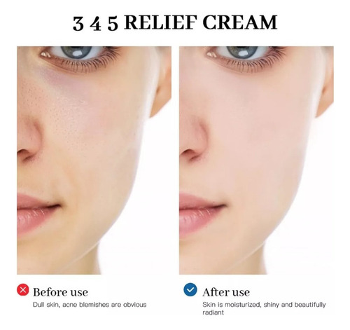 Crema De Alivio Mz 345, Crema Reparadora Intensiva 345
