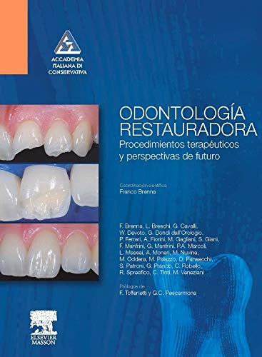 Libro Odontología Restauradora De Franco Brenna Ed: 1