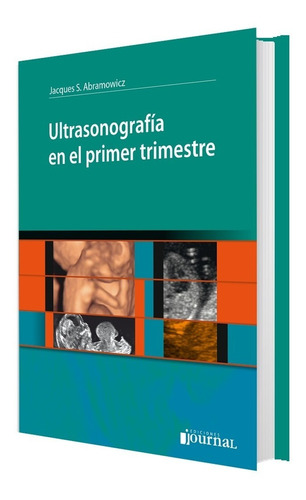 Ultrasonografía En El Primer Trimestre Abramowicz 