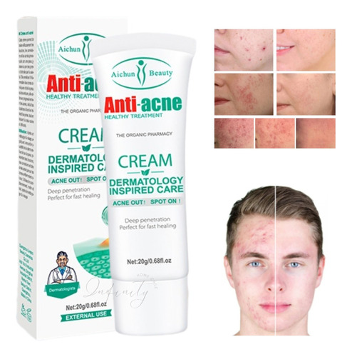 Crema Facial Anti Acné Cicatrizante Rapida