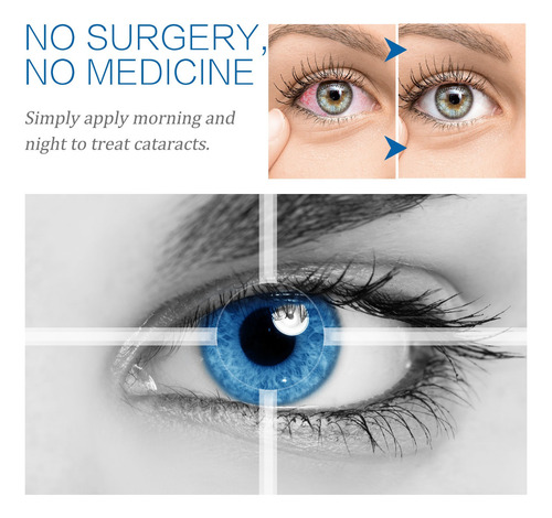 Gel De Olhos R Para Olhos Secos | Pomada De Alívio De Pálpeb