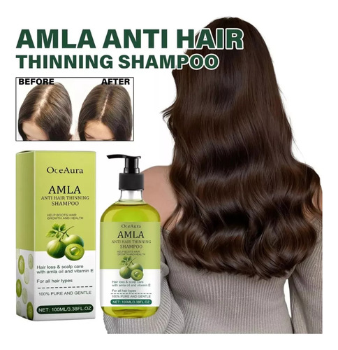 -- Shampoo Para Cabelos Com Phyllanthus Emblica, Limpador De