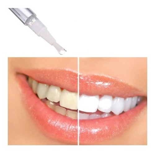 Imagen 2 de 3 de Lapiz Para Blanquear Los Dientes Luce Una Sonrisa Radiante