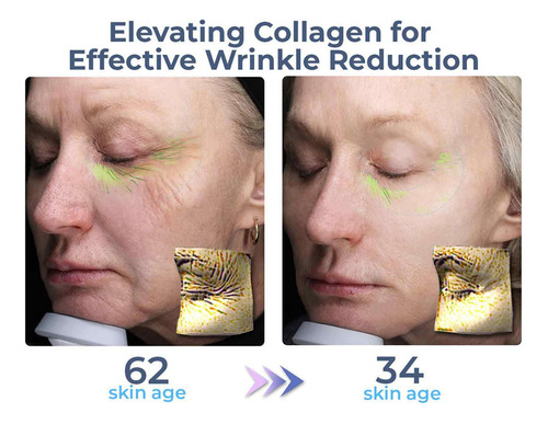- Crema Para Ojos Con Colágeno Avanzado Flysmus,