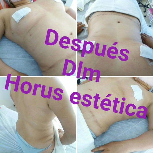 Imagen 9 de 10 de Drenaje Linfático Manual Post Quirúrgicos: Especialización