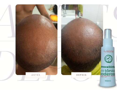 Tonico Poderoso Capilar 100ml Evolution Cresce Cabelo