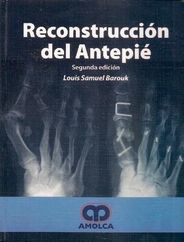 Libro Reconstrucción Del Antepié De Louis Samuel Barouk