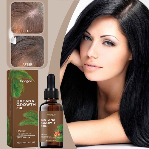 Aceite Para Reducir La Rotura Del Cabello, Extractos De Bata
