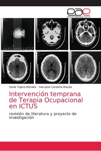 Libro: Intervención Temprana Terapia Ocupacional Ictus