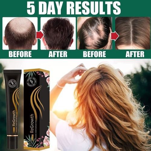 Suero Orgánico Para El Crecimiento Del Cabello Regrewth