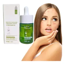 Comprar Suero Tratamiento Acné Ácido Salicílico Cuidado Facial 30ml Momento De Aplicación Noche Tipo De Piel Todo Tipo De Piel