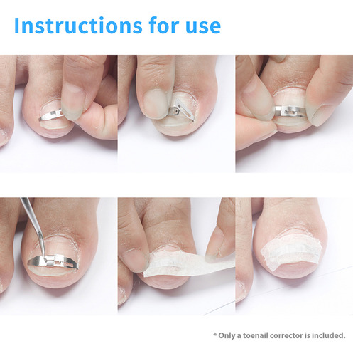 . Corrector De Uñas De Los Pies, 5 Unidades, Corrector De