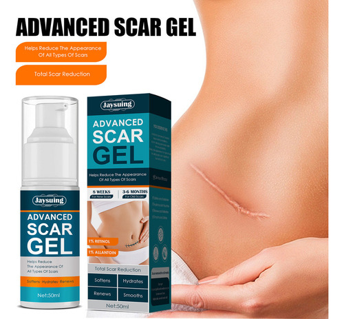 . Crema For Cicatrices En Gel J, Eliminación De Queloides,