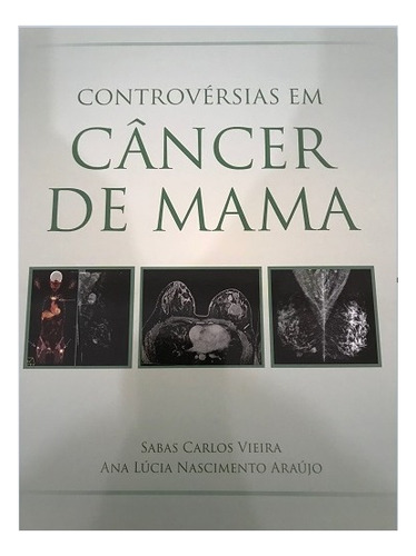 Controvérsias Em Cancêr De Mama, De Sabas Carlos Vieira,ana Lúcia Nascimento Araújo. Editora Goy Editora Em Português