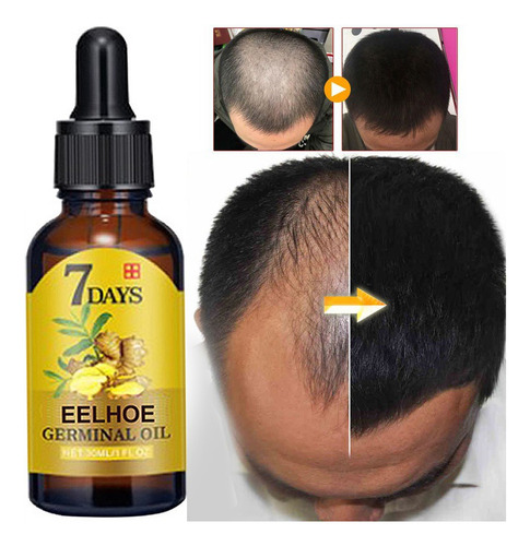 Produto Para O Cabelo Crescer Muito Rápido, Nutrindo, Evitan