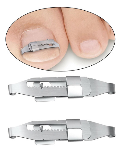 2 Uds Herramientas De Corrección De Uñas Encarnadas Clips