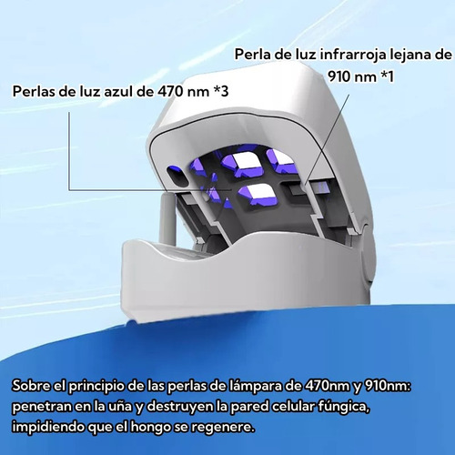 Tratamiento Láser De Hongos En Las Uñas Y Onicomicosis