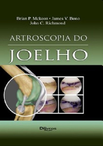 Livro: Artroscopia Do Joelho