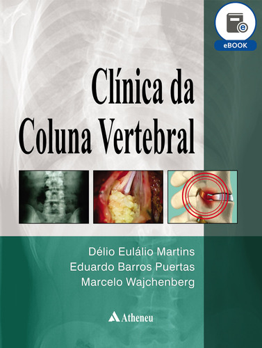 Clínica da coluna vertebral, de Martins, Délio Eulálio. Editora Atheneu Ltda, capa dura em português, 2014