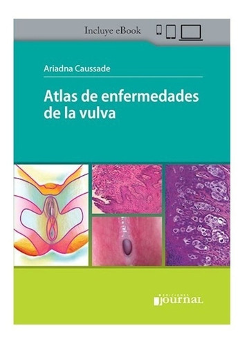 Atlas De Enfermedades De La Vulva-caussade Dutra + E-book