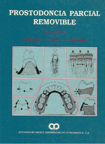 Libro Prostodoncia Parcial Removible De Kenneth L. Stewart,