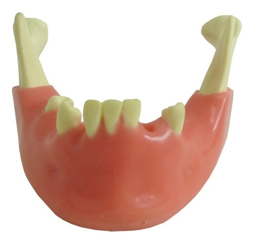 Mandíbula Com Alguns Dentes E Gengiva