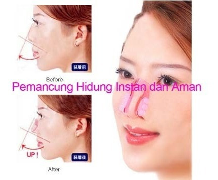 Respingada X Vida Corrector Nasal Externo Unisex Nose N Jmg
