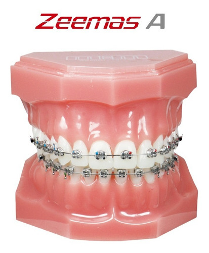 Imagen 2 de 2 de Caso De Brackets Mem Zeemas A Roth