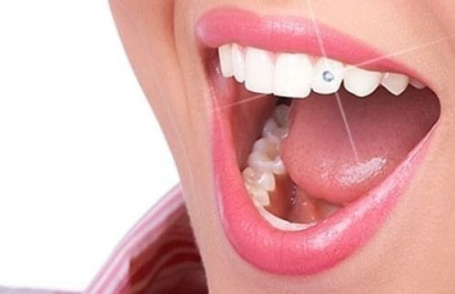 Piercing Para Dente - Cor Cristal