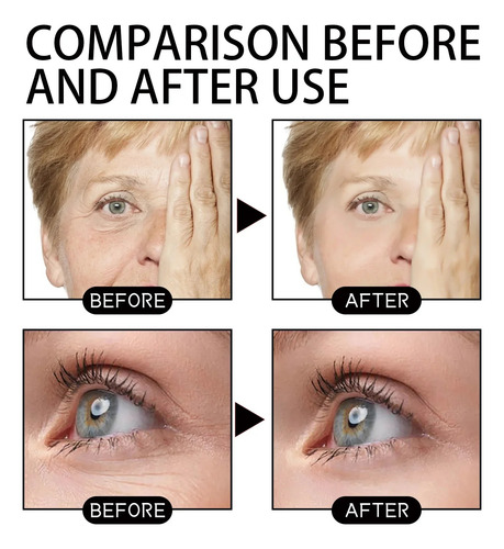 Sérum Antiarrugas Hialurónico Antiarrugas, Ácido Facial, Ant