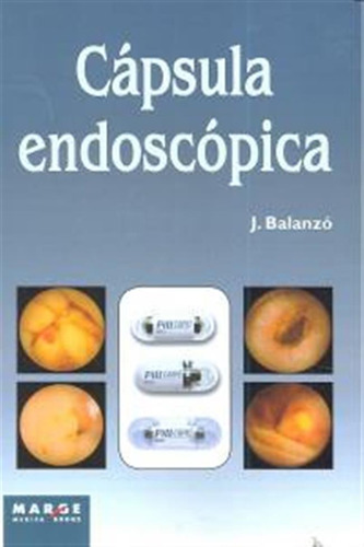 Capsula Endoscopica - Balanzo Tintore,joaquin