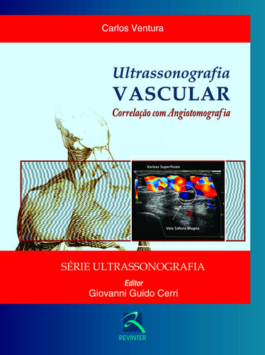 Ultrassonografia Vascular, de Cerri, Giovanni Guido. Editora Thieme Revinter Publicações Ltda, capa dura em português, 2015