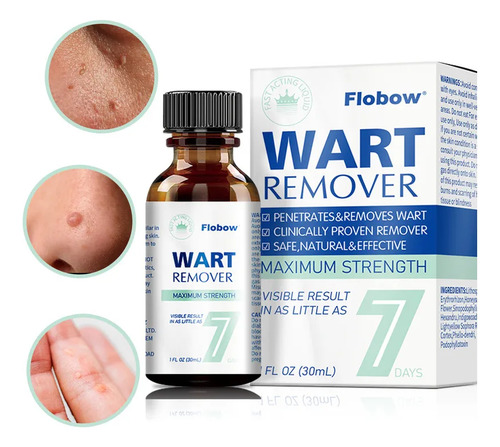 Tratamento E Remoção De Verrugas E Hpv