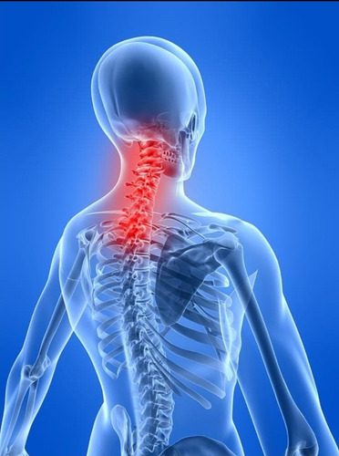 Tratamiento Desinflama Espalda Baja Y Cuello 100pz En Parche Hierbas
