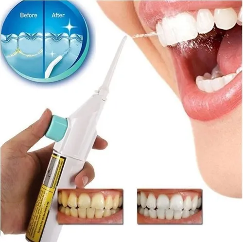 Limpiador De Dientes Electrico MercadoLibre