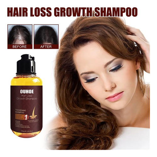Shampoo Para Cabelo Shampoo Para Espessamento De Cabelo Sham