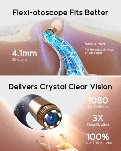 Limpador De Ouvido Bebird I35r 2025 Earsight Visual