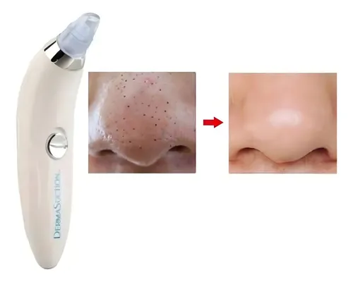 Dispositivo eléctrico de succión de puntos negros Vision Dermasuction
