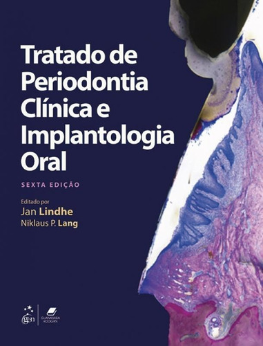 Tratado De Periodontia Clinica E Implantologia Oral - Guanab