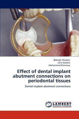 Libro Effect Of Dental Implant Abutment Connections On Pe...