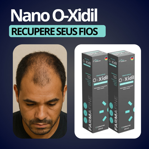 O-xidil Nano Tecnologia Capilar 120ml Farmafine