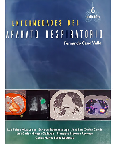 Enfermedades Del Aparato Respiratorio / 6 Ed., De Cano Valle, Fernando. Editorial Mendez Editores, Tapa Blanda, Edición 6.0 En Español, 2022